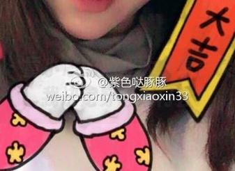 微密圈 - 童小芯的黑丝大分享：灵感突发，我决定穿它出门去！